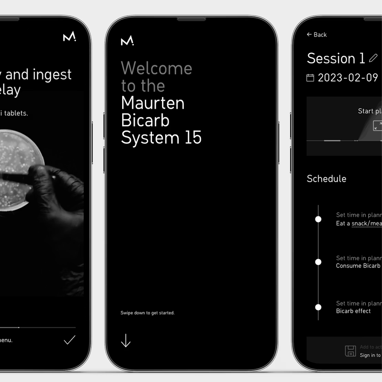 Bicarb System alternate view